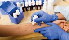 ALLERGIES ACARIENS, PROTÉGEZ-VOUS !